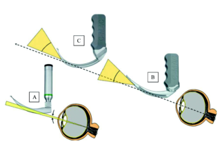 Video & Direct Laryngoscopy