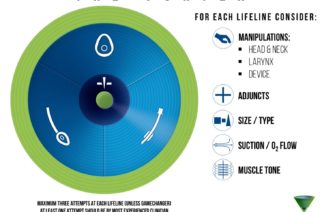 The Vortex Approach to Airway Management