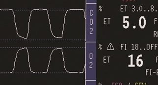 Support the Implementation of Gas Monitroing in Areas of Resuscitation #SIGMAR