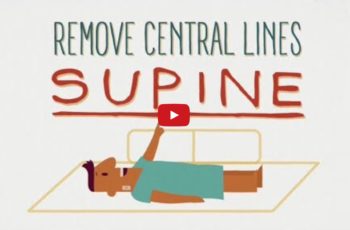 Remove Central Lines Supine